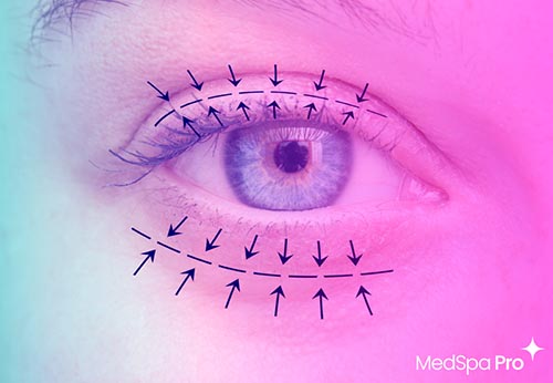 Expanding Aesthetic Horizons: Why Oculoplastics Deserves a Place in Your Practice